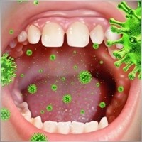 koklush