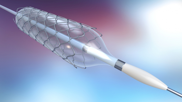 PLSE Shares Positive First-in-Human nPulse Cardiac Catheter Data