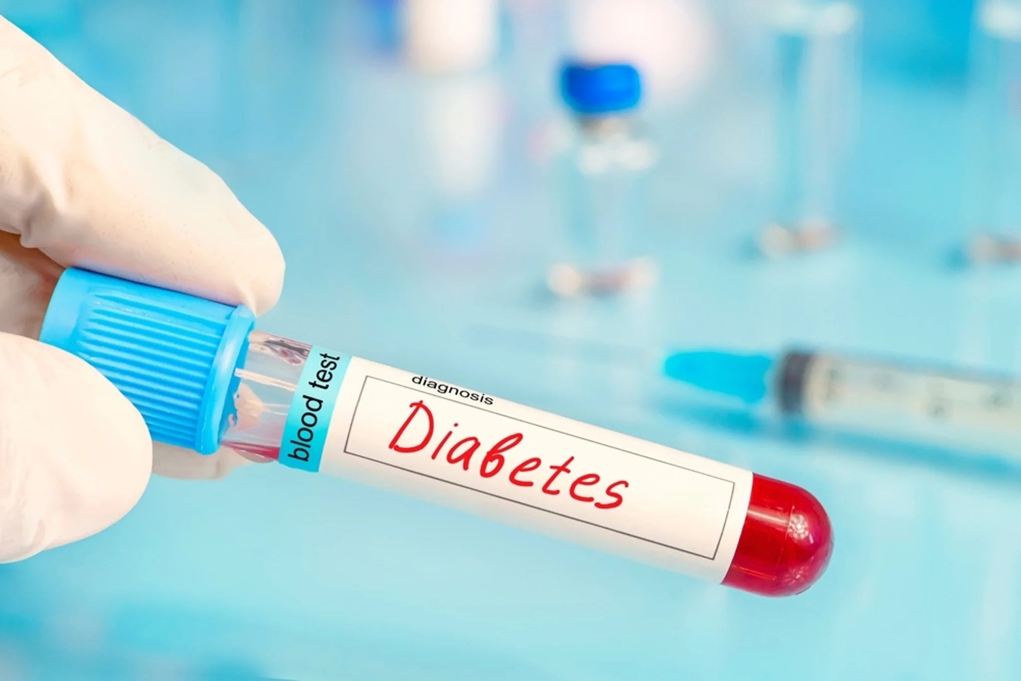 La valeur d'Organogenesis s'envole après que l'essai sur les ulcères du pied diabétique ait enregistré une victoire statistiquement significative | Benzinga France